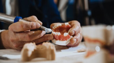 rodzaje protez zebowych